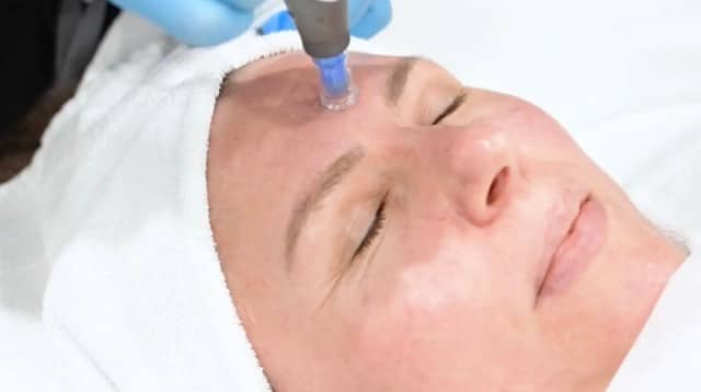 HydraFacial treatment in progress