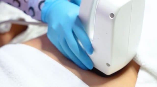 InMode BodyFX body contouring treatment