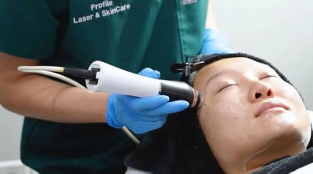 OxyGeneo treatment at Profile Laser & SkinCare