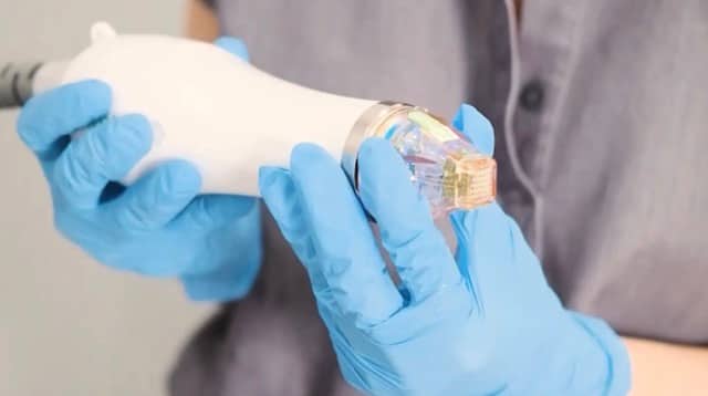 Secret PRO handpiece treatment at Profile Laser & SkinCare
