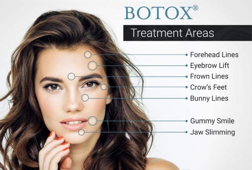 Dermal filler treatment