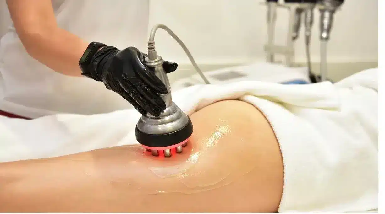truSculpt flex body toning