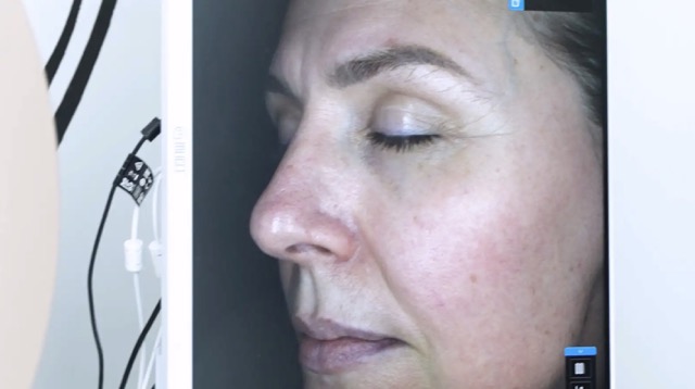 AI skin analysis facial imaging